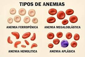 Causas de la anemia